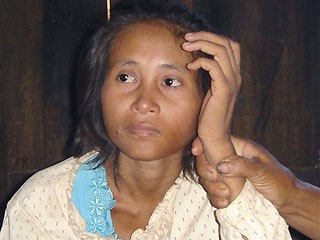 Cambodian Feral Human