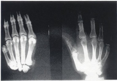 Biscardi X-Ray