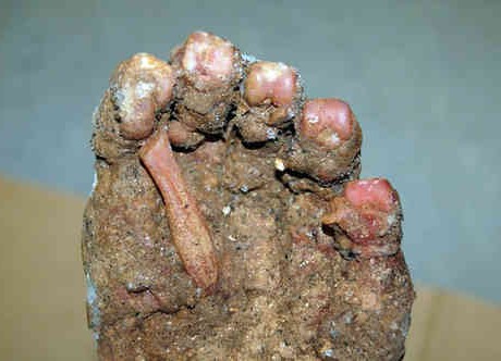 Virginia Mystery Ape Foot